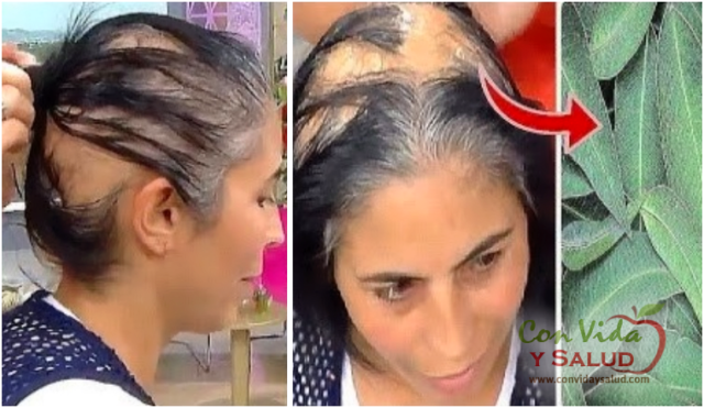 Plantas que te ayudarán a frenar la caída del cabello – Con Vida y Salud